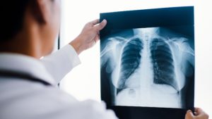 Types of Orthopedic Imaging Tests - x-rays