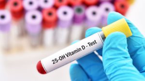vitamin d test in udaipur - arth diagnostics